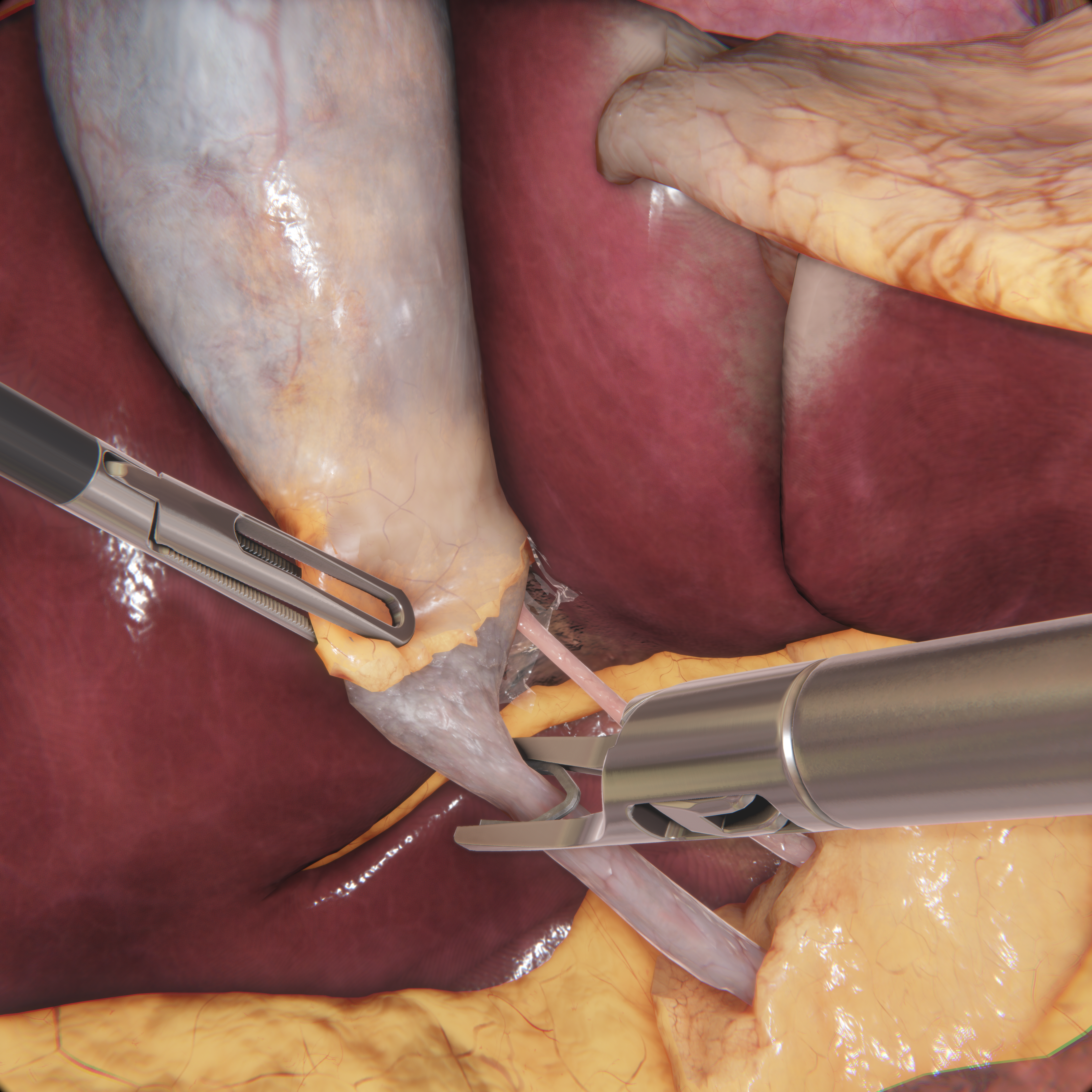 Image of laparoscopic surgery training