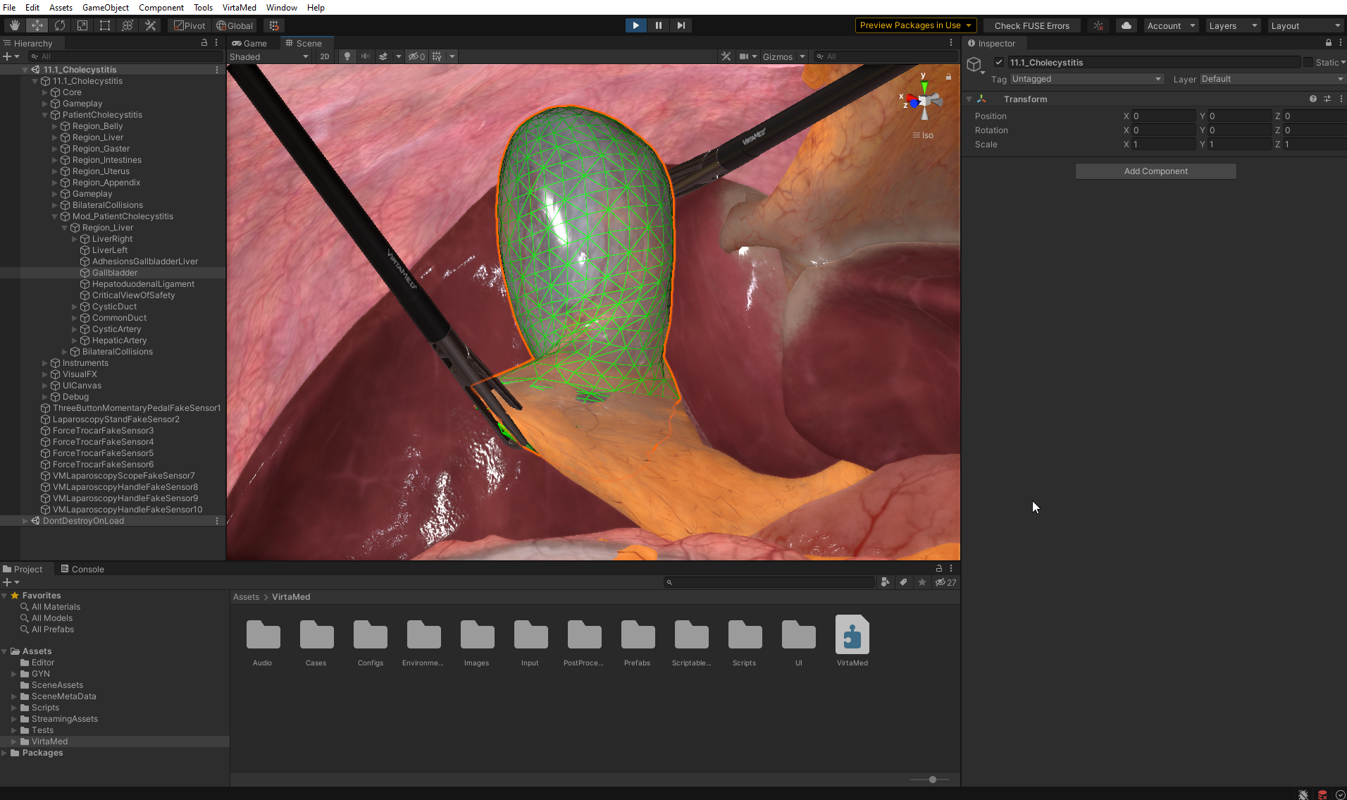 The laparoscopic surgery app built in Unity